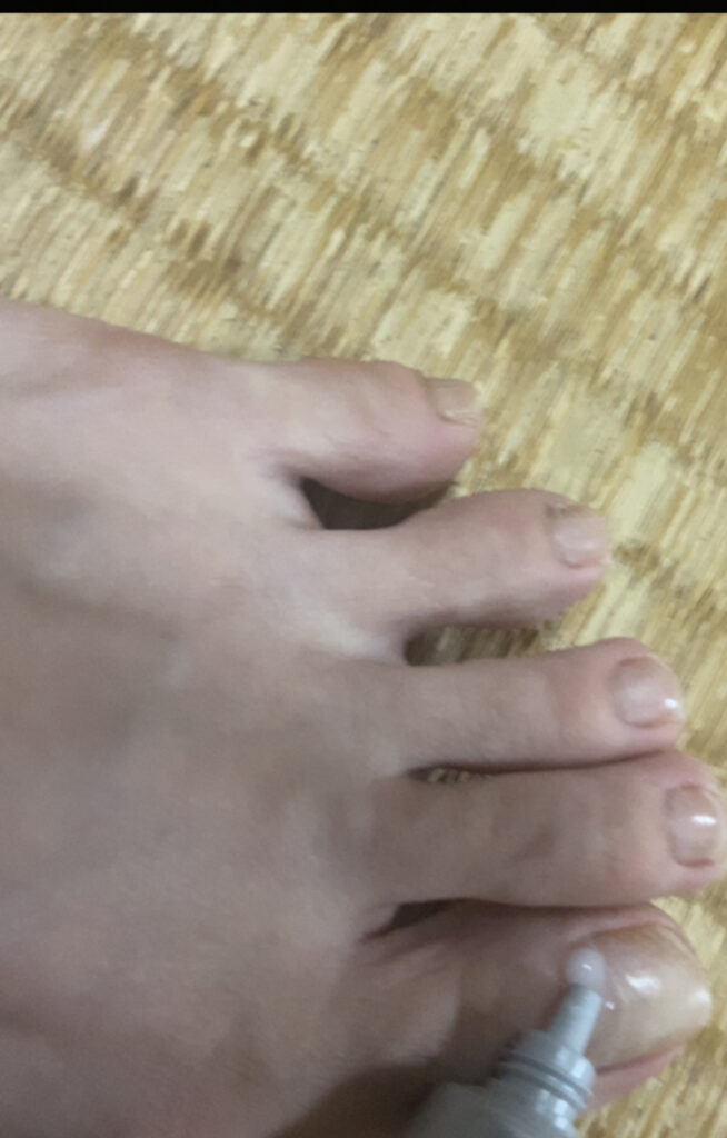 足の爪ケア